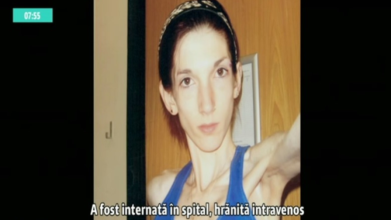 Drama tinerelor care sufera de ANOREXIE: „Nu voiam sa stau in apropiere de bucatarie” Imagine