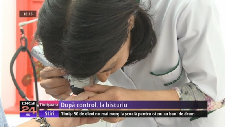 Dupa control, la bisturiu. Alunitele pot produce in timp cancer de piele Imagine
