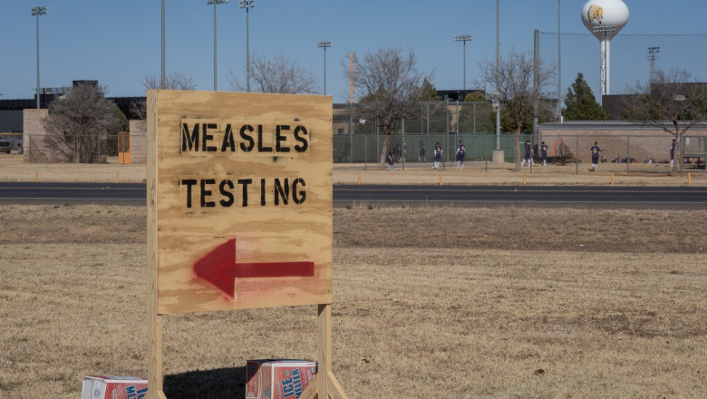 Epidemia de rujeola din Texas s-a extins la statele limitrofe, dupa ce a izbucnit intr-o comunitate religioasa care respinge vaccinarea Imagine