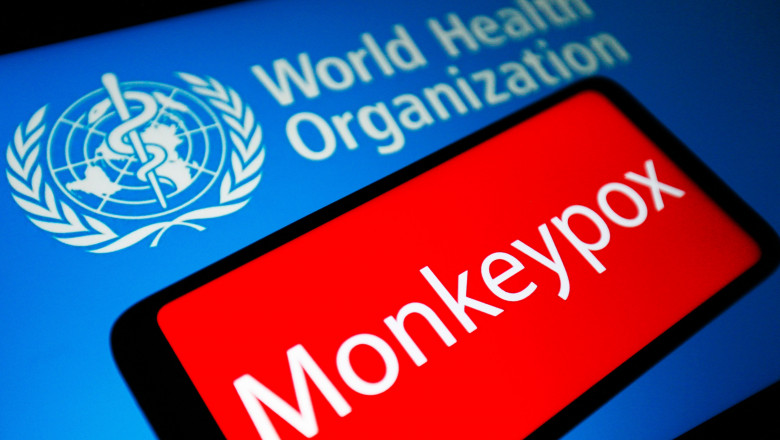 Epidemia de „variola maimutei” se raspandeste in mai multe tari africane. OMS convoaca un comitet de urgenta  Imagine