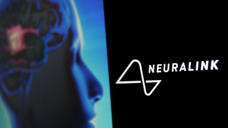 Esec pentru Elon Musk. Primul cip Neuralink implantat a inceput sa se desprinda de creierul pacientului Imagine