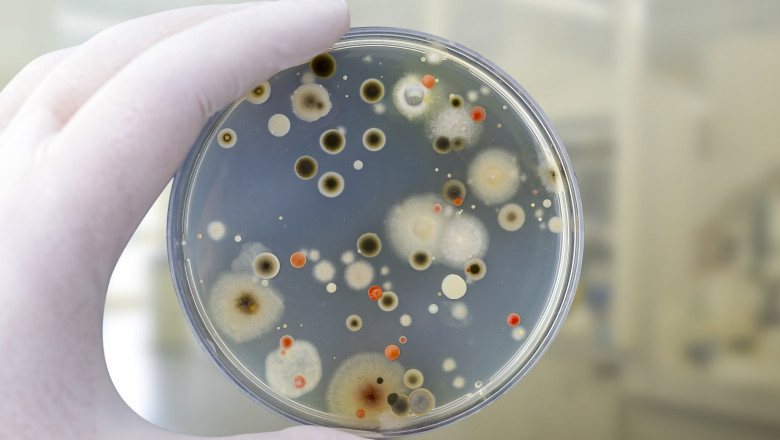 Experiment Digi24. Oamenii se expun la bacterii periculoase, fara sa-si dea seama. Greselile pe care le facem Imagine