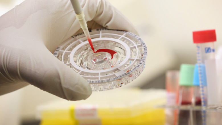 Experimente neautorizate, la neurochirurgie. Patru pacienti au murit, dupa proceduri chinuitoare Imagine