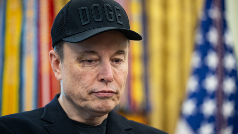 Explicatia lui Elon Musk pentru vanataile de pe fata sa: l-a lovit fiul sau, X Imagine