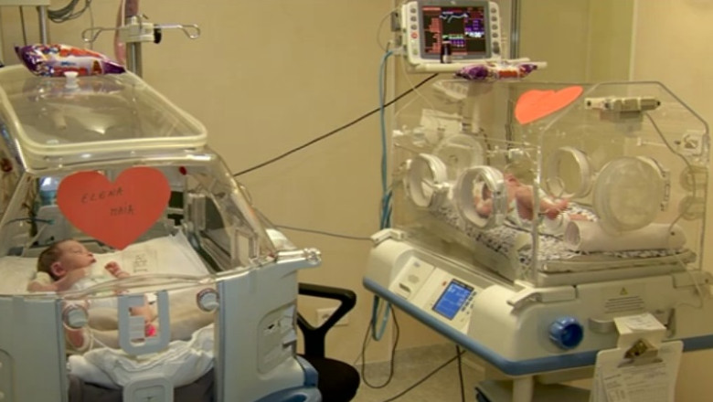 Fetitele siameze operate la "Marie Curie" se simt bine si sunt gata sa mearga acasa Imagine