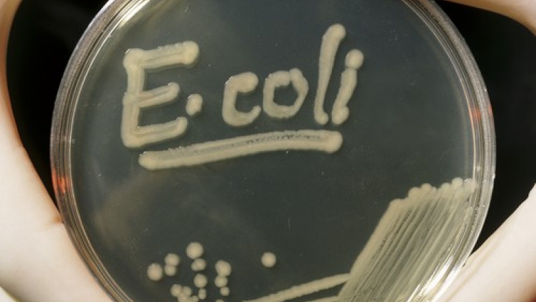 Focar de E.coli in Marea Britanie provocat de o salata din sandvisuri: O persoana a murit Imagine