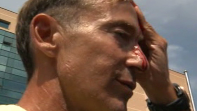 FOTO VIDEO. Radu Mazare, plin de sange Imagine