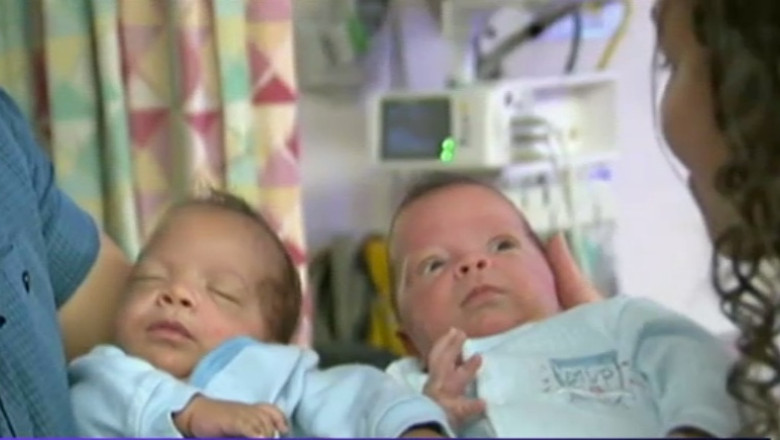 Gemeni nascuti la interval de 24 de zile Imagine