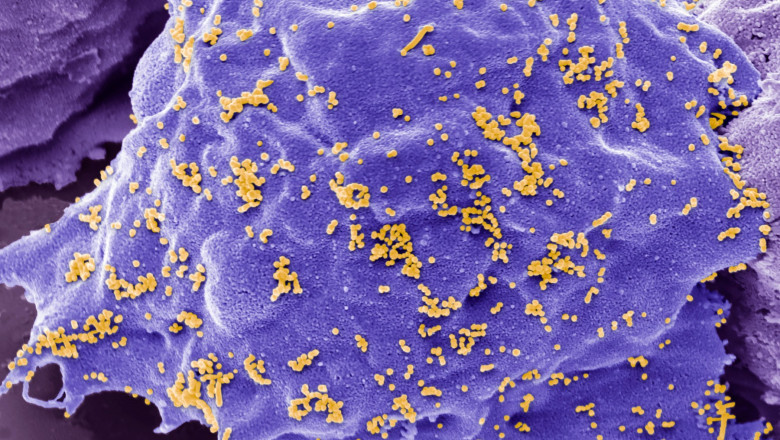 Gena umana care impiedica aparitia gripei aviare ar putea preveni o pandemie Imagine