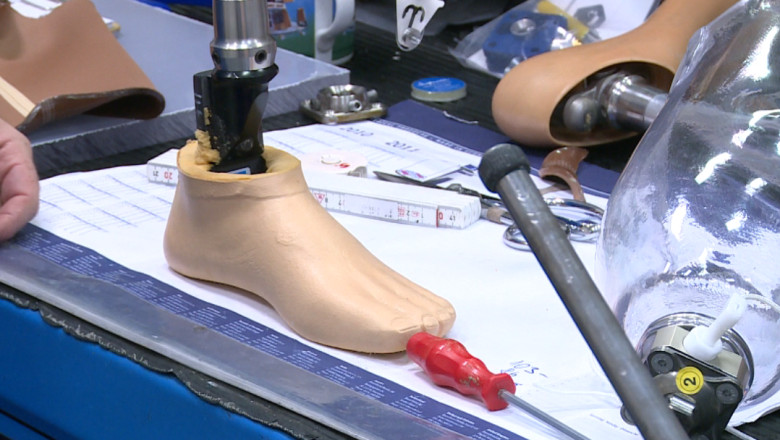 IASI. Liste de asteptare pentru proteze. Pacientii trebuie sa astepte si opt luni de zile Imagine