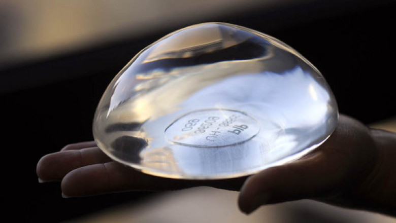 Implanturi cu silicon pentru saltele in loc de silicon medical: Romancele pot cere despagubiri in instanta Imagine