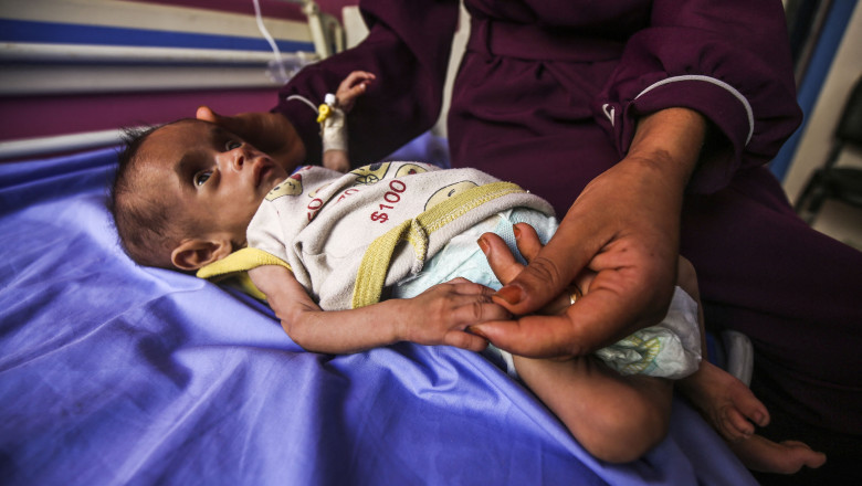 „Infometare in masa”. Numarul copiilor subnutriti din Gaza, cu varste sub 5 ani, s-a triplat in ultimele doua saptamani Imagine