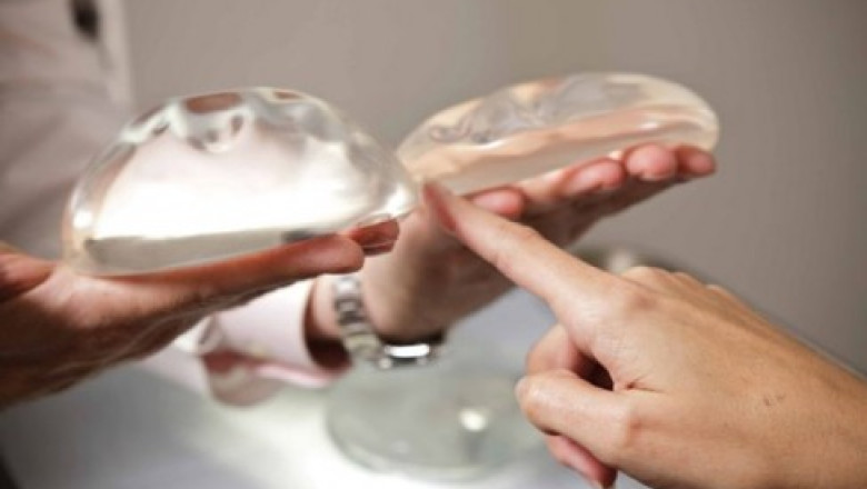 Initiativa legislativa. Din 2014, reconstructia mamara ar putea fi suportata de la bugetul de stat Imagine