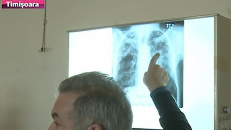 Invatatoare diagnosticate cu TBC. 20 de elevi au fost propusi pentru un tratament preventiv Imagine