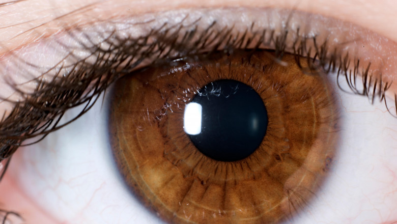 Judecatorii iranieni au condamnat doi barbati si o femeie sa-si piarda un ochi Imagine