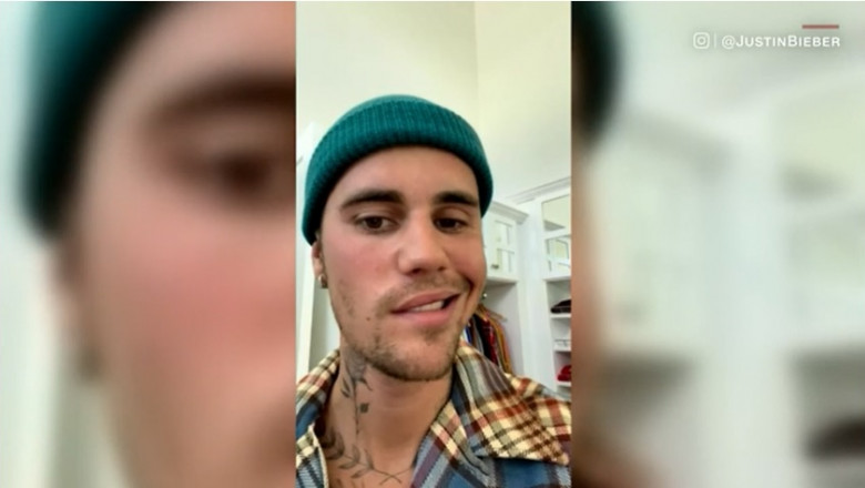 Justin Bieber anunta ca are paralizie faciala din cauza sindromului Ramsay Hunt Imagine