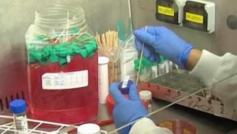 Londra, „capitala tuberculozei”. Numarul de imbolnaviri din metropola creste alarmant Imagine