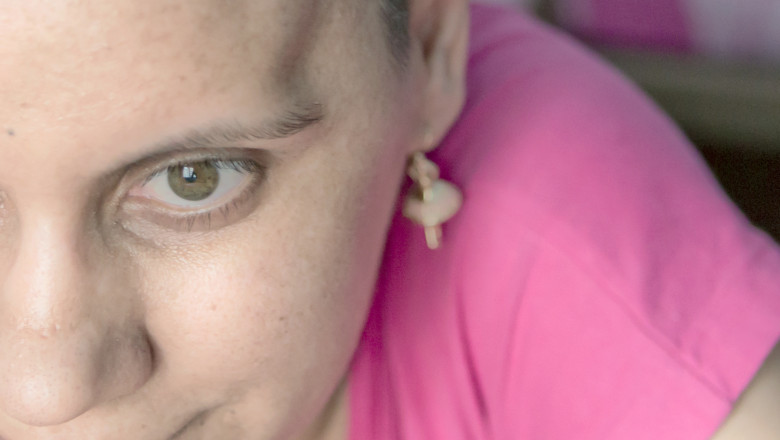 Luca Niculescu si mai multi fotoreporteri renumiti sprijina o tanara in lupta impotriva cancerului Imagine