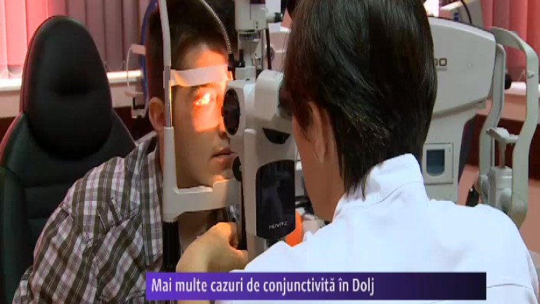 Mai multe cazuri de conjunctivita in Dolj Imagine