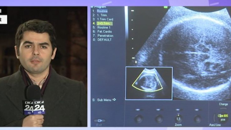 Mama naturala chiar daca nu a nascut Imagine