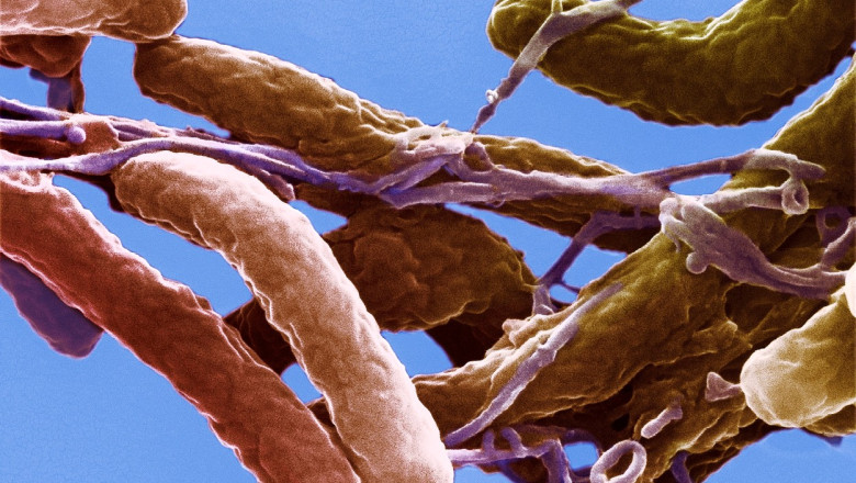 Masuri sanitare speciale in Israel dupa ce a fost descoperita bacteria care provoaca holera Imagine