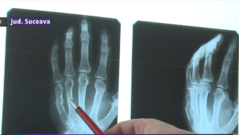 Medic agresat in spital Imagine