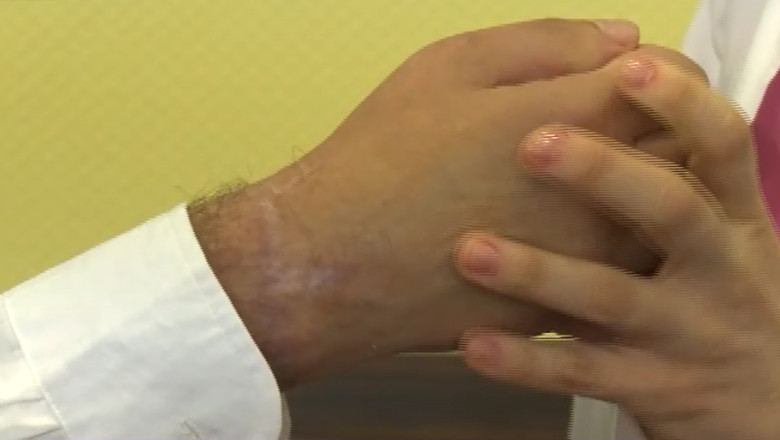 Medicii din Bacau au refacut mana unui tanar dupa sase ore de operatie  Imagine