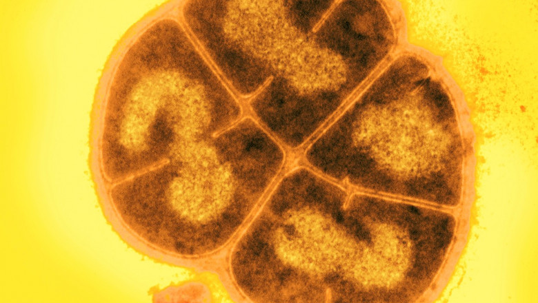 Microbii ar fi putut rezista sute de milioane de ani sub suprafata planetei Marte. Cazul supravietuitorului "Conan Bacteria" Imagine