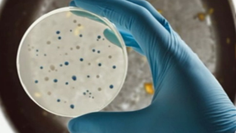 Microbii din casa. Cat de des trebuie schimbate tigaile, pernele, cosmeticele Imagine