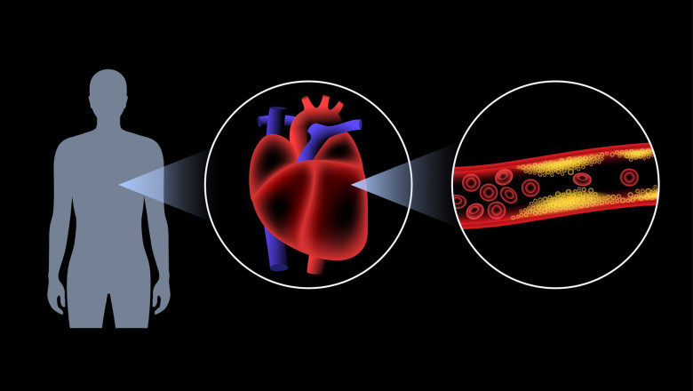 Milirobotii medicali. Oamenii de stiinta au gasit o metoda prin care se pot deplasa mai usor in interiorul vaselor de sange Imagine