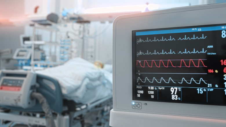 Ministerul Sanatatii vrea sa cumpere echipamente medicale pentru sectiile ATI din tara Imagine