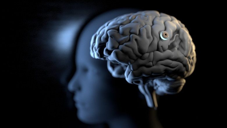 Neuralink spune ca in sase luni va putea realiza implanturi conectate in creierul uman Imagine