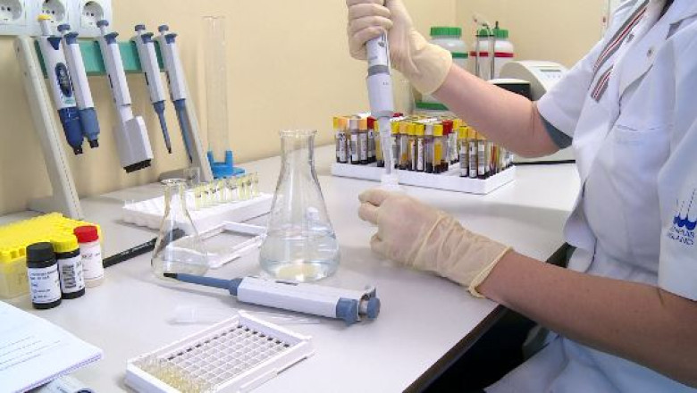 Nu se mai fac teste gratuite pentru HIV Imagine