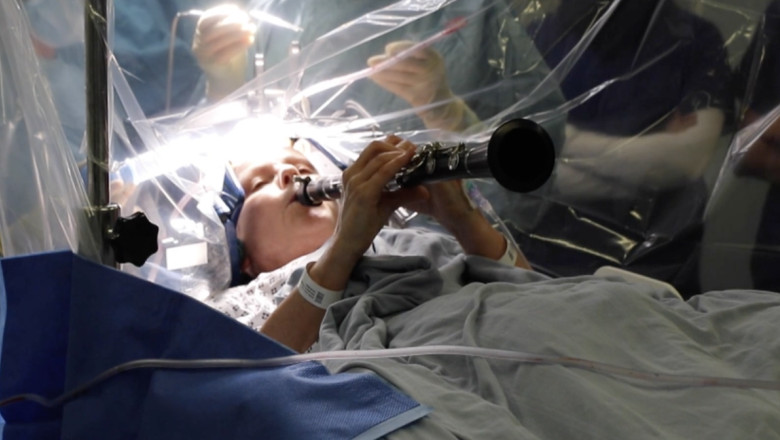 O femeie a cantat la clarinet in timpul unei operatii pentru Parkinson. Ce interventie a suferit si cum o poate ajuta Imagine