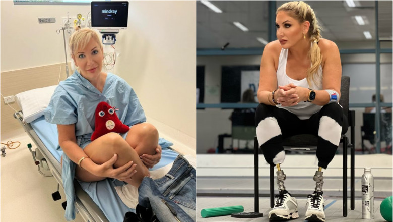 O femeie a fost in coma doua saptamani, a suferit 47 de operatii si si-a pierdut ambele picioare de la o muscatura de tantar Imagine