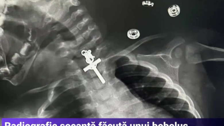 O fetita de 10 luni a inghitit un crucifix care i s-a blocat in gat Imagine