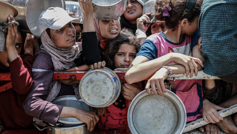 O fetita de doar 5 luni din Gaza a murit de foame. Esraa cantarea mai putin decat la nastere Imagine