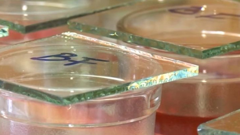 O mie de femei din Bacau asteapta de trei luni sa afle daca sufera de cancer de col uterin Imagine