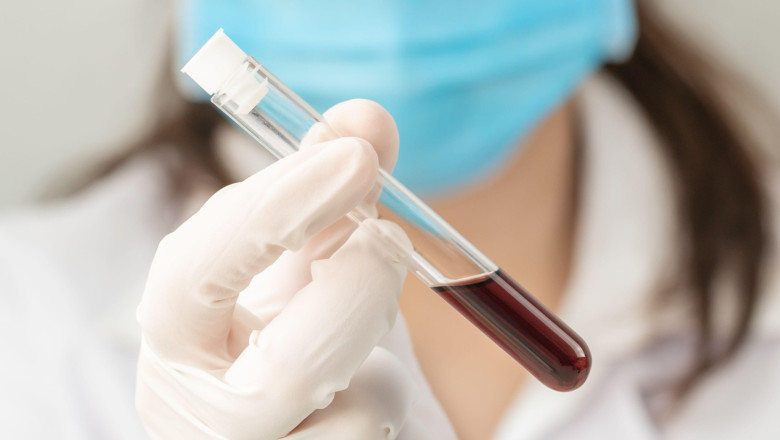 O noua grupa de sange, descoperita la o femeie din Guadelupa. „Este singura persoana din lume compatibila cu ea insasi” Imagine