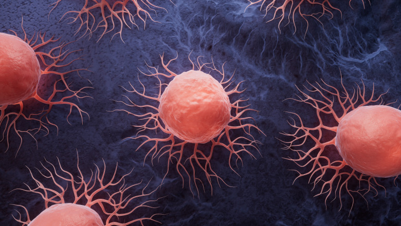 O noua metoda pentru „a reduce la tacere” mutatiile genelor care cauzeaza cancer a fost descoperita de cercetatori Imagine