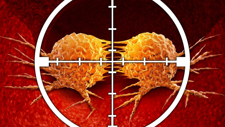 O „pilula distrugatoare de cancer” revolutionara care „anihileaza” tumorile a inceput sa fie testata pe oameni Imagine