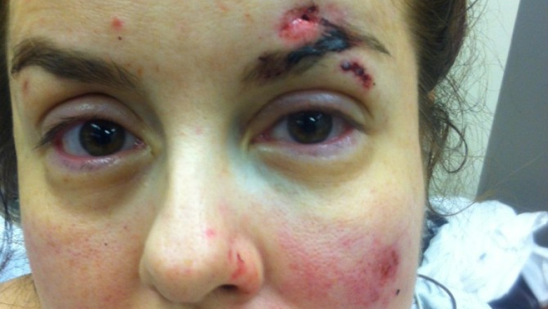 O romanca din Canada a fost batuta de un politist pentru ca a depasit viteza legala Imagine