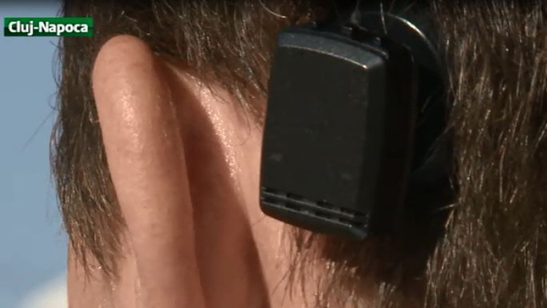 Operatii putine si scumpe Imagine