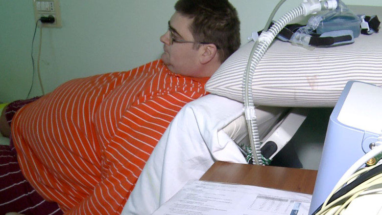 Pacientul de 300 de kilograme a slabit sapte kilograme in sapte zile. Operatia e insa departe Imagine