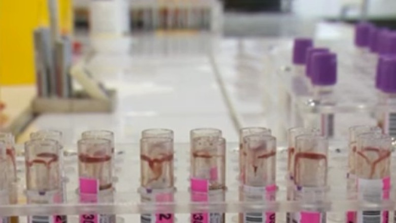 Persoanele cu risc de imbolnavire vor fi testate gratuit impotriva hepatitei B Imagine