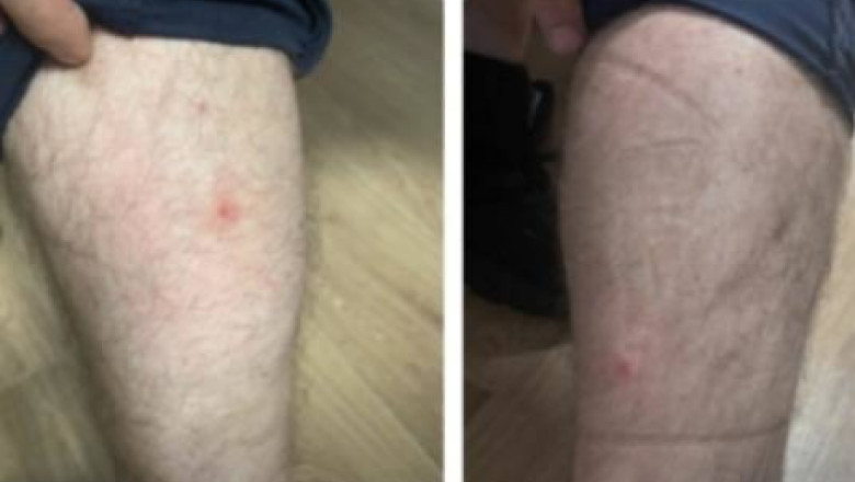 Politisti muscati de plosnite in sediile Politiei Capitalei, zece persoane au ajuns la Urgenta. Reactia conducerii DGPMB Imagine