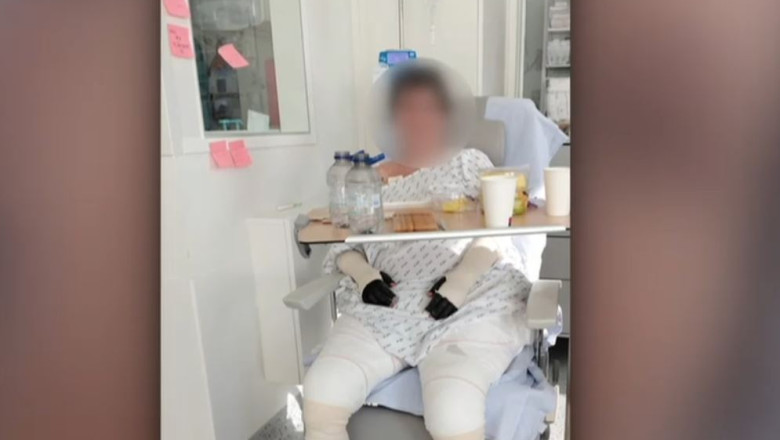 Povestea care a facut statul sa-si recunoasca greselile: Lavinia, pacienta cu arsuri de la Floreasca trimisa in Belgia, va fi externata Imagine