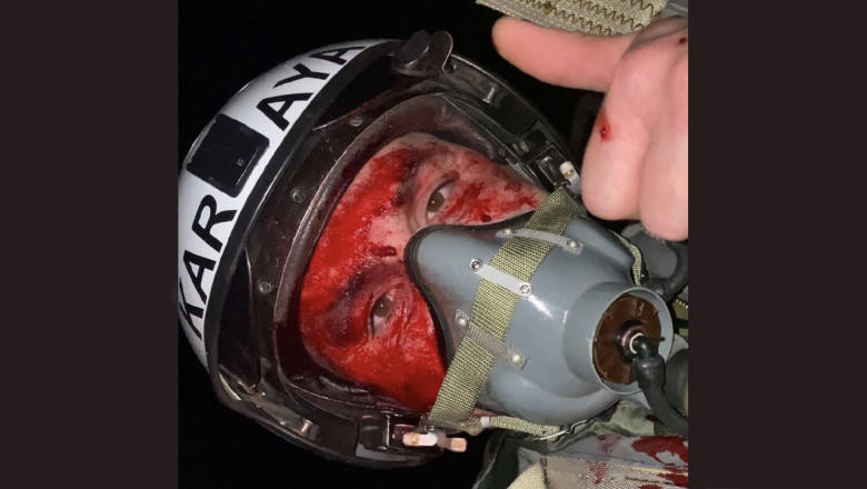 Povestea incredibila a eroului ucrainean care si-a facut selfie dupa ce s-a catapultat din avionul avariat: Nimeni nu ne poate distruge Imagine