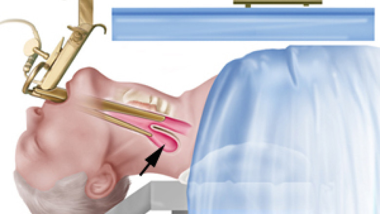 PREMIERA. Interventie endoscopica la Fundeni, realizata de olandezul care a inventat metoda Imagine