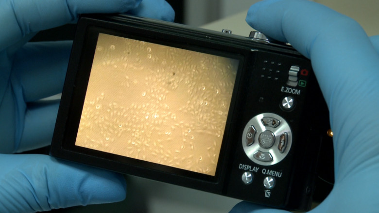 Premiera nationala la Iasi: Intr-un laborator al UMF a fost produsa piele artificiala Imagine